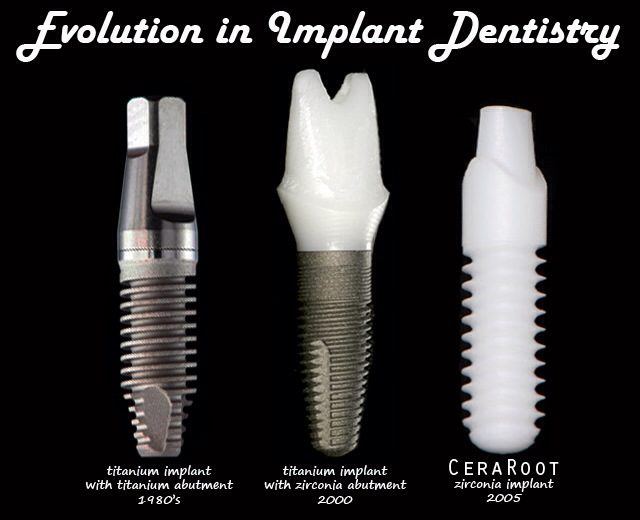 CeraRoot Zirconia Dental Implants tools