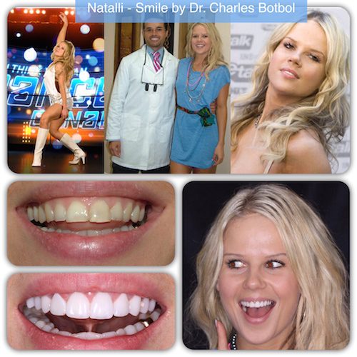 Natalli - Smile by Dr. Charles Botbol