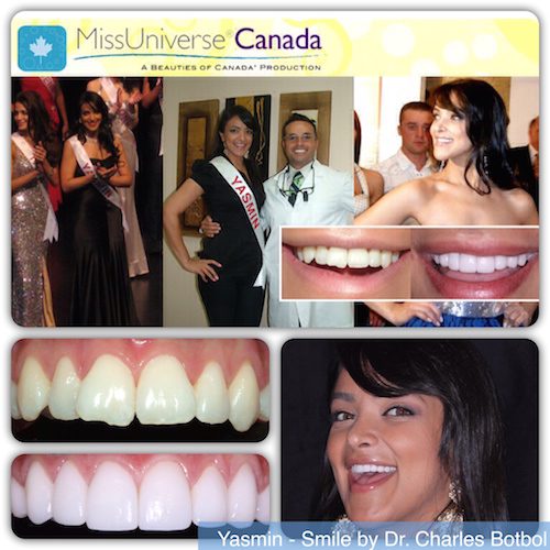 missuniverse canada - Smile by Dr. Charles Botbol