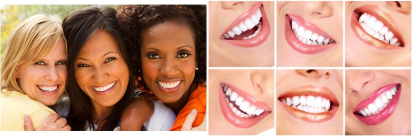 How to Choose a Cosmetic Dentist?