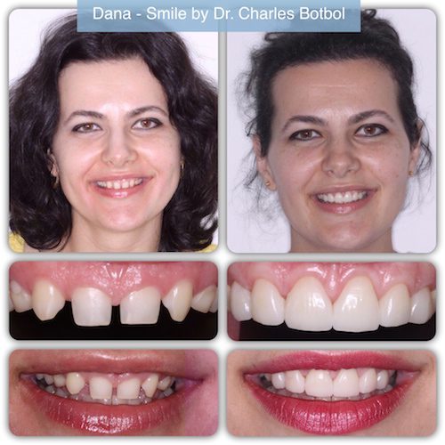 Dana- Smile by Dr. Charles Botbol