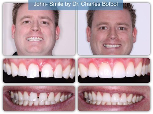 John - Smile by Dr. Charles Botbol