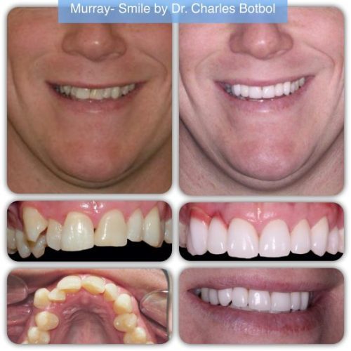 Murray - Smile by Dr. Charles Botbol