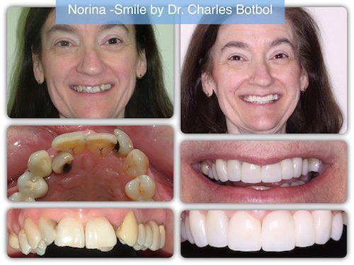 Norina - Smile by Dr. Charles Botbol