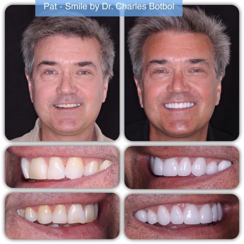 pat - Smile by Dr. Charles Botbol