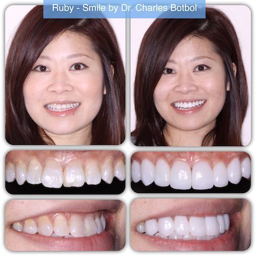 Ruby - Smile by Dr. Charles Botbol