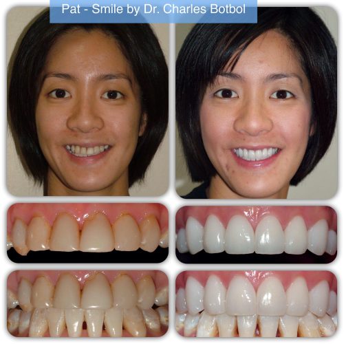 pat - Smile by Dr. Charles Botbol